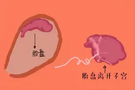 胎盘在前壁和后壁有什么不同吗？图片