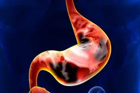 消化科医生呼吁：停止食用1“鸡蛋”，或会加重胃病，请撤下餐桌图片