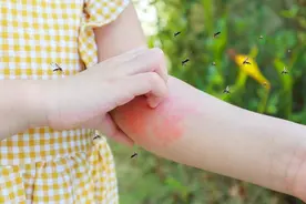 迟了会得脑膜炎！孩子被蚊子咬后出现这6种情况，一定要去医院！图片