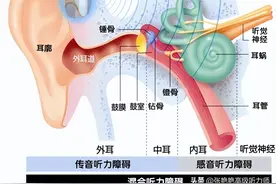 听力下降不可能恢复正常了？不是，要看你属于哪种图片
