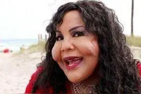 爱上25岁小伙。40岁女子去整容，脸颊生出大疙瘩，禁不住放声大哭图片