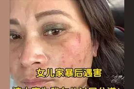 网红可乐教练跳河去世！生前被家暴浑身伤，脸上全是疤指甲被折断图片