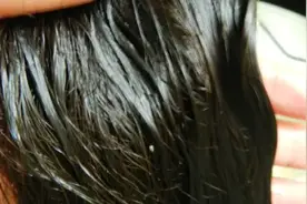 头发爱“出油”，到底是哪里出了问题？提醒：或是湿气重的缘故图片