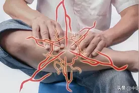 腿疼、腿麻、腿抽筋，补钙没用？中医：再厉害的抽筋也怕这两味药图片