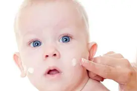 孩子湿疹到底能不能用激素类药膏？副作用有多大？一文讲清楚图片