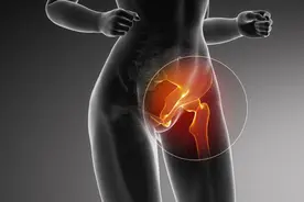 屁股痛，大腿根痛一直好不了，这种髋病一半患者被误诊图片