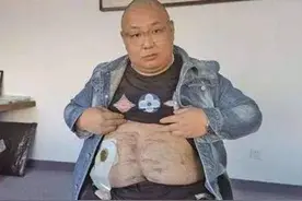 200多天过去了，当初见义勇为被砍的南京胖哥，后来到底怎么样了图片