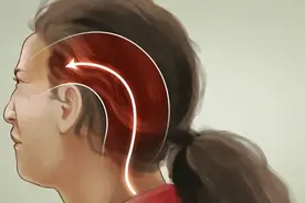 这根神经最怕你「低头」，头疼、头麻是被压迫的表现图片