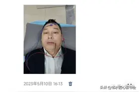 面瘫是病，不说面子 | 刘金（四川邻水）图片