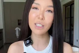 36岁模特杜颜嘉截肢后复出，曾经历严重烧伤事故，左手被烧到炭化图片