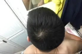 孩子头上的“旋”代表什么？真和智商性格有关吗？今天告诉你答案图片