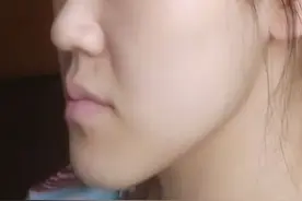 地包天正确改善方式，拒绝变成“月亮脸”图片