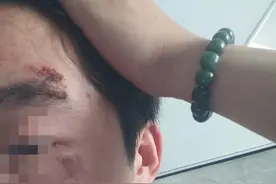 男子遭别车群殴后续！不和解改刑事，对方被判全责，已刑拘一人图片