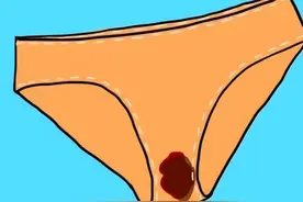 为什么女生的内裤里总是有一层“黄黄”的分泌物？正常吗？图片