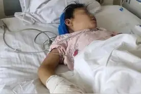 太恶毒！开水烫，吃小米椒，桶下体，甘肃幼女遭后妈虐待致残图片