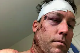 噩梦！BC男子陷ICBC新“潜规则”，行人被车撞只能认倒霉…图片