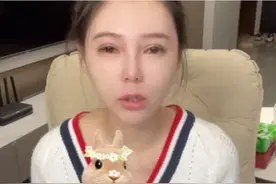 女网红晒整容前后对比照，直言整容太多脸部松弛老10岁，后悔痛哭图片