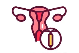 曼月乐很舒服？看完这篇能少走很多弯路图片