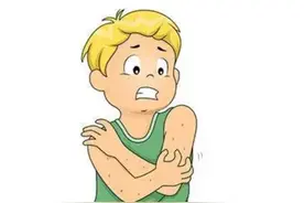 身上吃海鲜过敏起的疙瘩痒吃点什么药图片