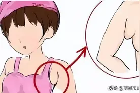 腋下多了鸡蛋大小一坨肉，医生提醒：副乳有这三种情况需手术切除图片