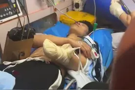 网红石佳明被砍掉手后续！逃跑者遭抨击，凶手猖狂表示不满14岁图片