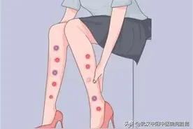 腿上起红色小疙瘩很痒怎么解决图片