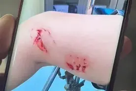 头条晚报丨张文宏被造谣妻子是药代；官方回应浴场不明鱼类伤人图片