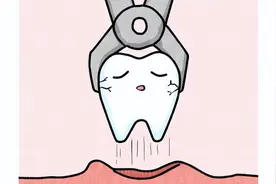 拔完智齿后留下一个“洞”怎么办？多久才能恢复正常？图片