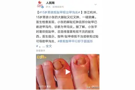 疼疼疼！甲沟炎，多是因为剪指甲习惯错了图片