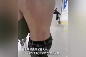 高校女生冲男同学泼开水致二度烧伤，放话大不了装抑郁，后续来了图片