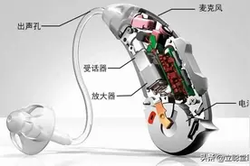 选助听器还是人工耳蜗？全方位对比告诉你图片