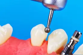 6000与8000种植牙区别在哪里？图片