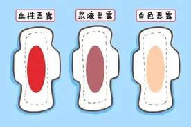 产后恶露是怎么一回事？图片