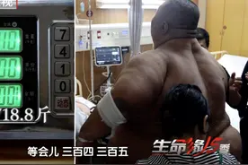 小伙体重达718斤冲上热搜！半年狂减300斤！医生提醒......图片