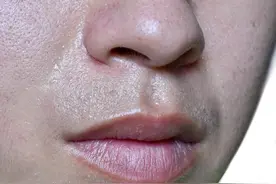 夏天饭后头部出汗？这个简单小方子让你告别“汗泡饭”！图片