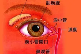 眼睛无缘无故流泪是病图片