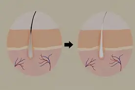 “鼻毛变白”是衰老的前兆吗？医生：或还有其他原因，男性要留意图片