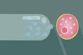 女性避孕用“避孕环”，是好是坏？4种女性不适合用，保护好子宫图片