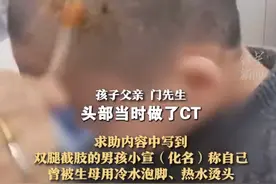 父亲称儿子被生母虐待致截肢，“冷水泡脚、热水烫头”，当地回应：母亲已被警方批捕，将帮扶孩子后续治疗图片