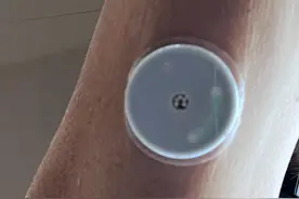 新的血糖监控方式图片