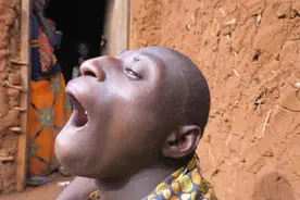 非洲的一个孩子被村民称为猴子、猩猩，经常袭击路人图片