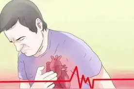 支架手术后戒烟戒酒，不到2年再次心梗？医生说3个原因导致复发图片