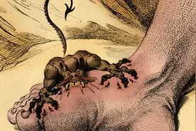 为何痛风者愈来愈多？“祸根”是豆制品？医生坦言：4物嘴下留情图片