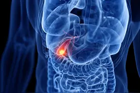 擅长偷袭且“可防不可治”的胆囊癌，赶紧了解一下图片