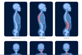 早上醒来腰酸，是不是强直的“晨僵”？图片