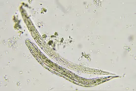 提醒：6种食物是寄生虫的“重灾区”，宁愿不吃，也要少碰图片