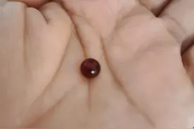 鼻子塞珠子了怎么解决图片