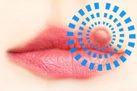 嘴角起泡是上火？提醒：除此之外，还与这些因素有关，需对症处理图片