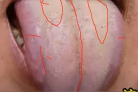 走路腿发沉，湿热顽固难愈，中医教你，除湿补虚，理顺肝气！图片