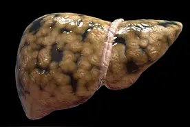 午睡和不午睡的孩子，有什么区别，长大之后到底哪个更聪明？图片